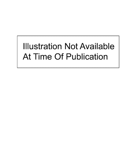 1985 Dodge Lancer Fascia Kit Air Dam Diagram for 82213329AB